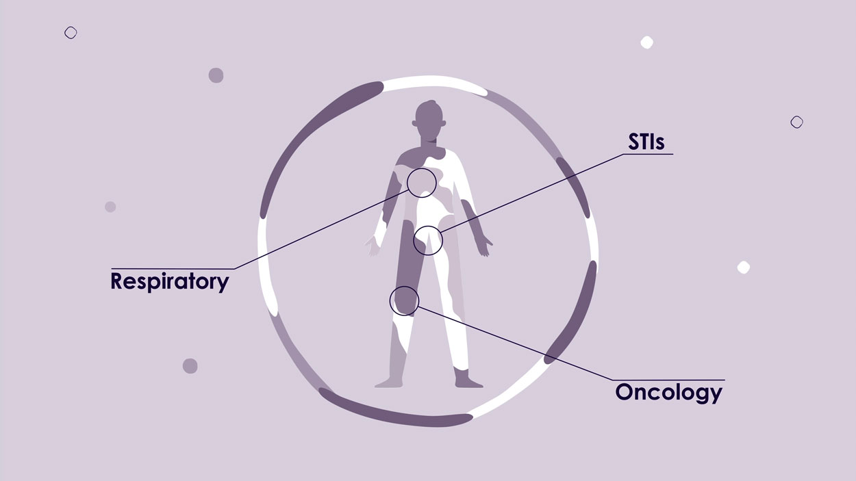 Medical Animation Examples